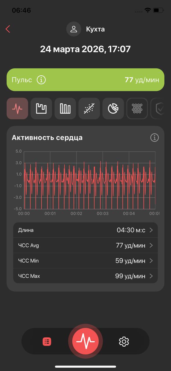 Референс активность сердца