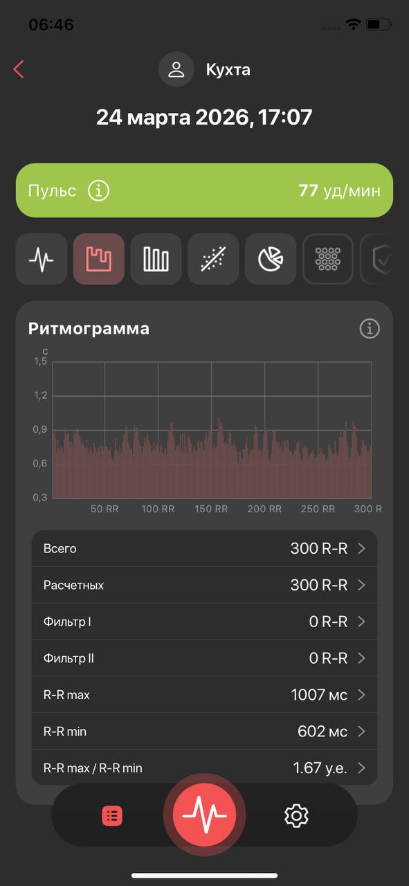 Референс ритмограмма